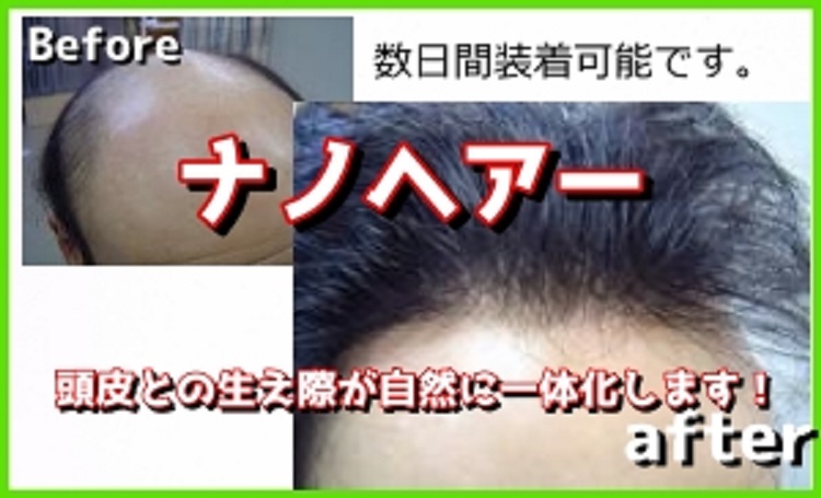 あーとばらんすちば