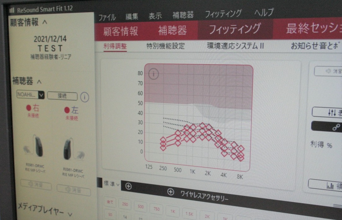 聞こえに不安を感じたら早めに検討を