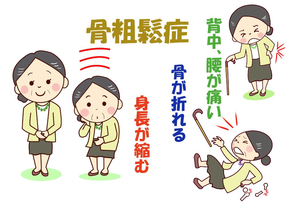 骨がもろいだけじゃない!?放置すると恐ろしい骨粗しょう症