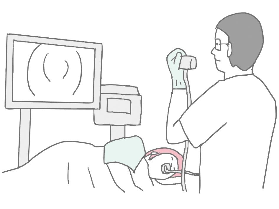 胆石症のはなし 超音波内視鏡検査
