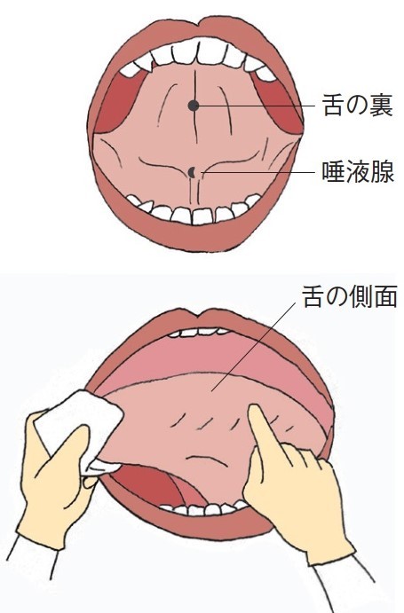 歯科受診後に医科受診が必要になる病気