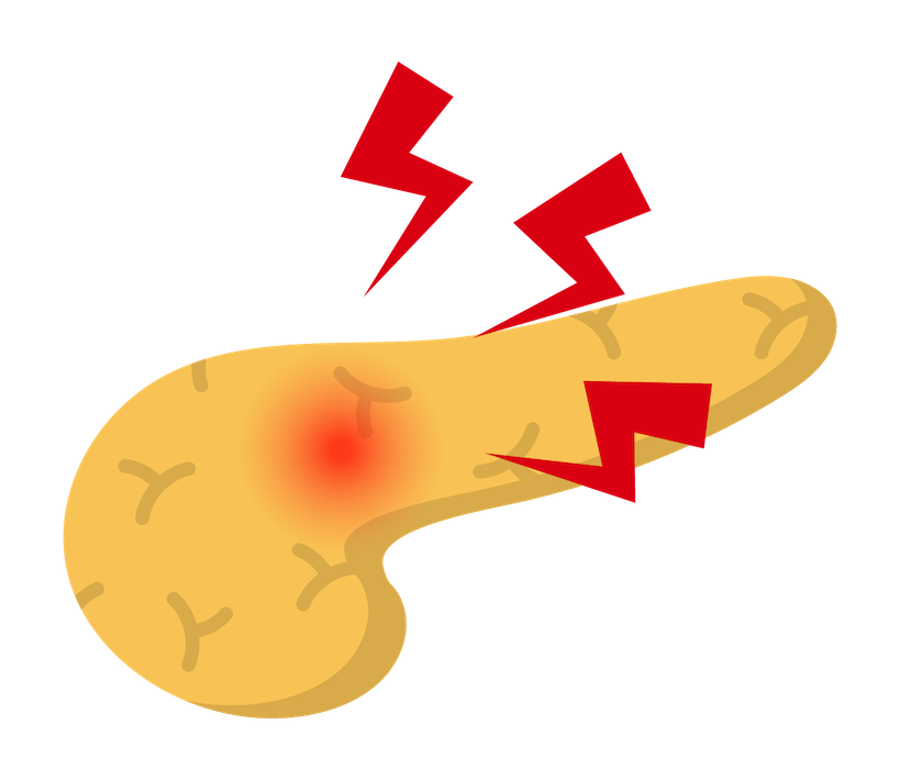 沈黙のがんを見逃さない、諦めない 船橋市の「すい臓がん早期診断プロジェクト」