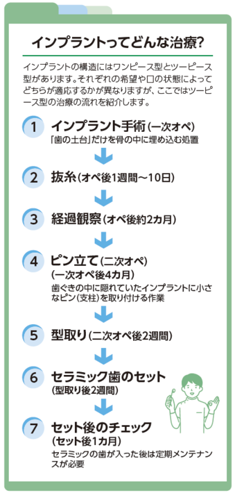 インプラントってどんな治療?