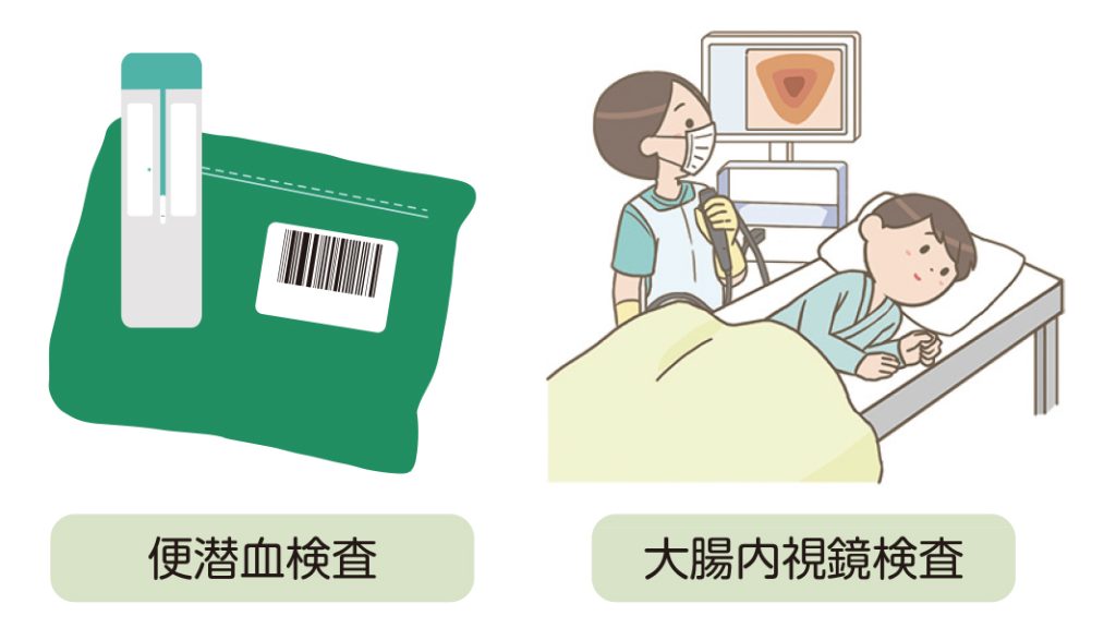 早期発見で自分を守ろう 大腸がんと検査の話