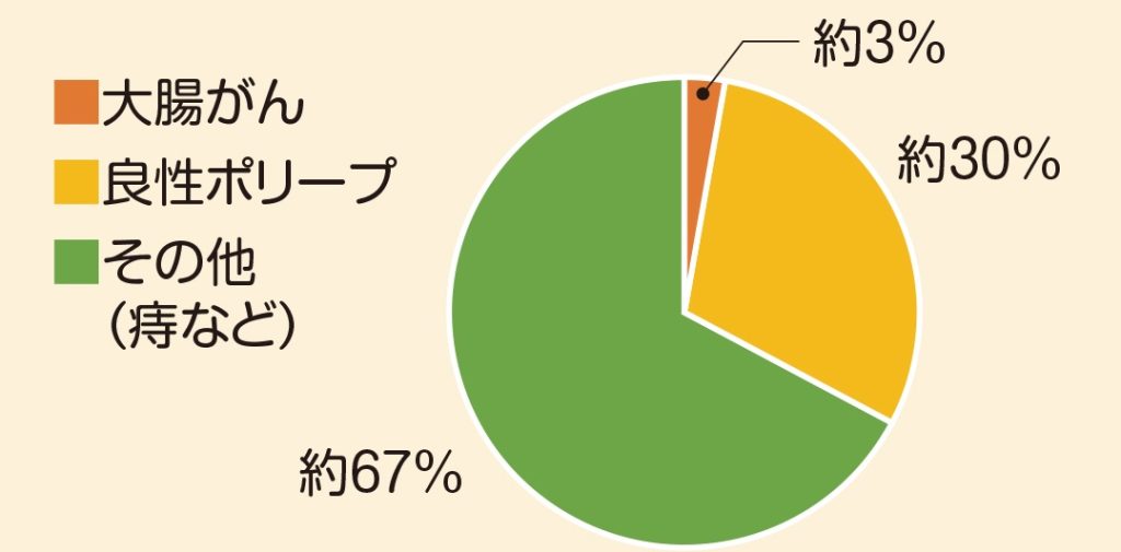 早期発見で自分を守ろう 大腸がんと検査の話